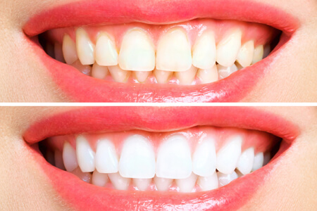 Poinsett Dental Associates